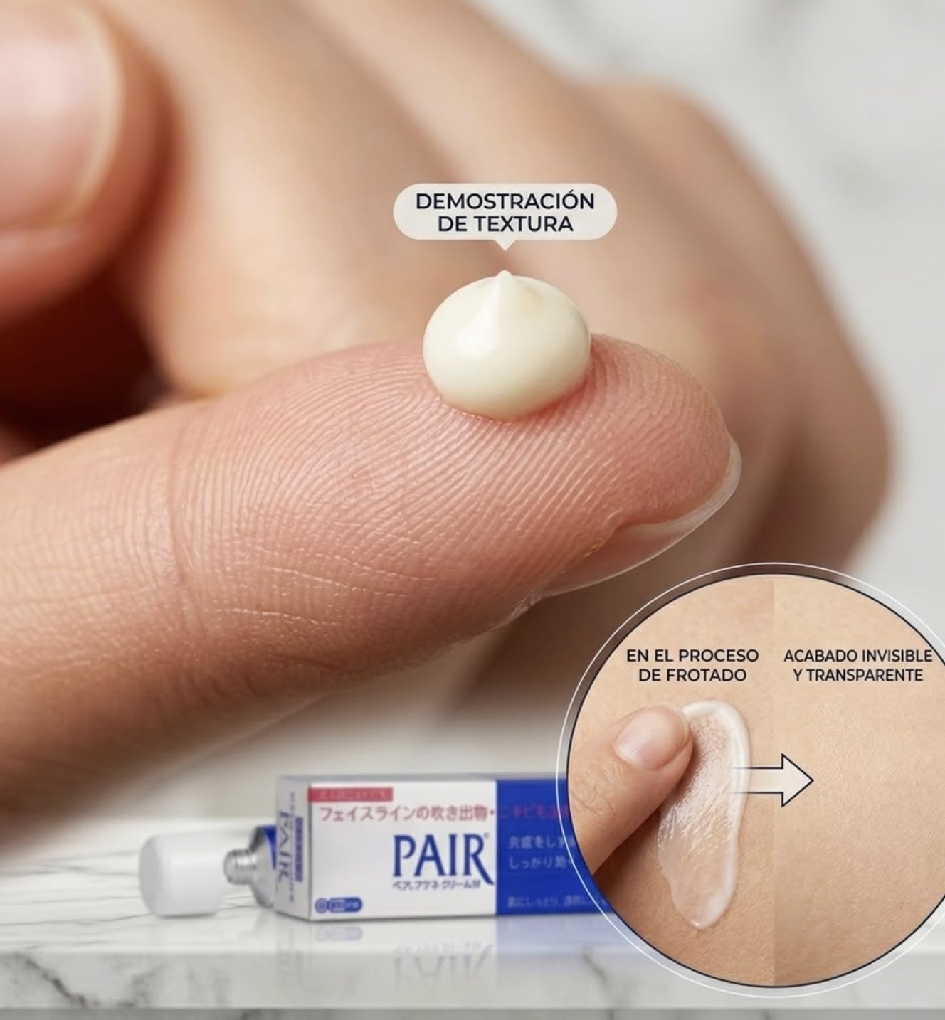 Pair Acne Cream W 14g (LION)