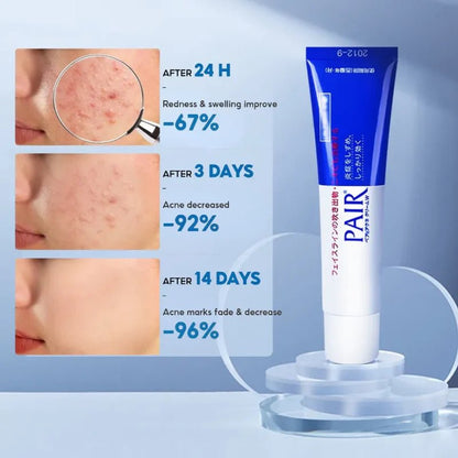 Pair Acne Cream W 14g (LION)